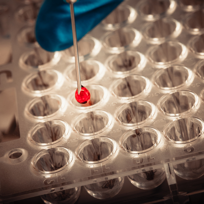 Arjantin'de 40 kişi öldü! Dang humması korkutuyor!