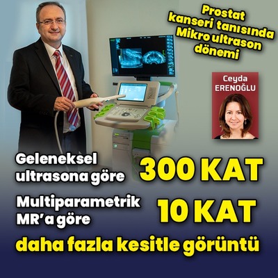 Prostat kanseri tanısında Mikro Ultrason dönemi