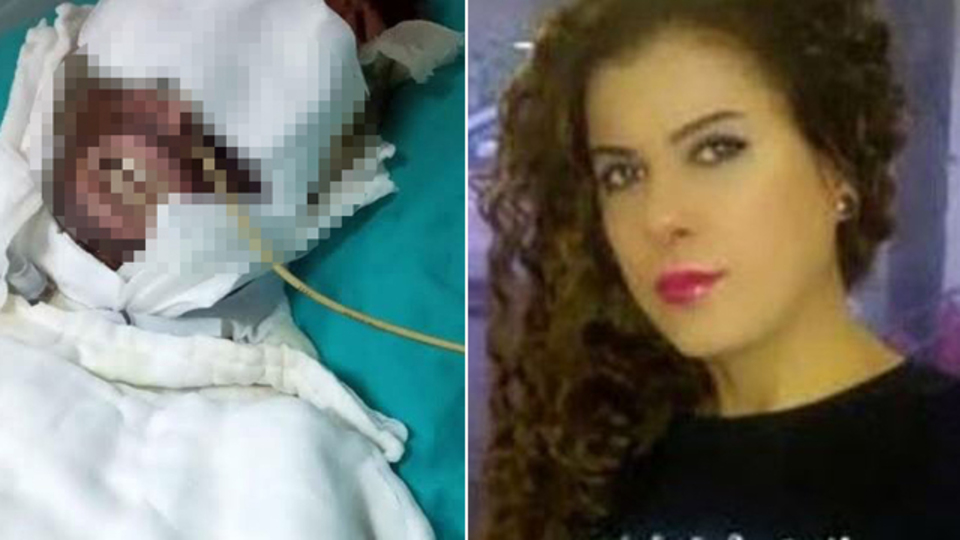 Sevgilisini kimyasal maddeyle yaralamıştı! Pişkin savunma!