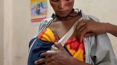 Ortalama kilonun altında ve prematüre bebeklere kanguru bakımı önerisi