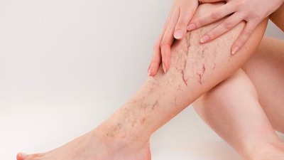 Varisle ilgili rahatlama sağlıyor! Küçük ama etkili hareket