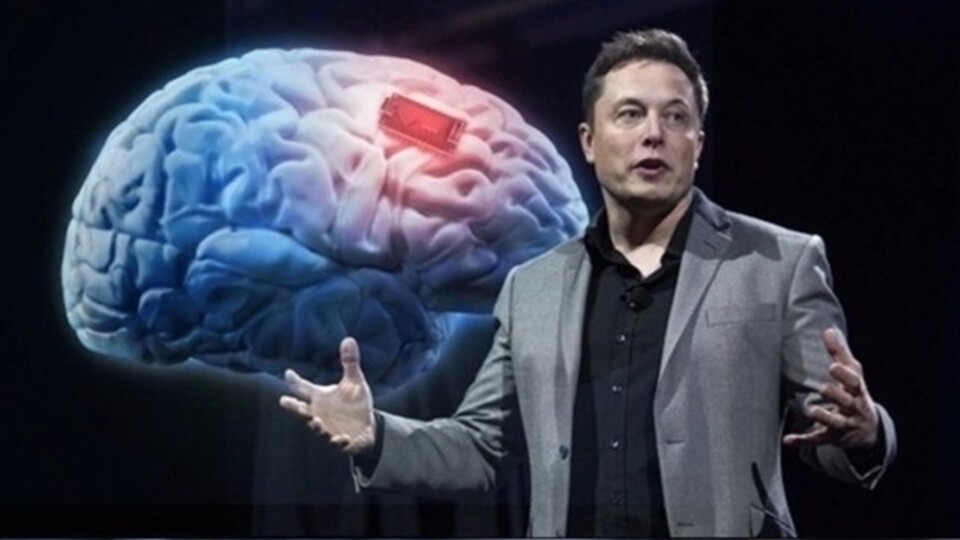 Beyin çipi deneylerine onay çıktı!