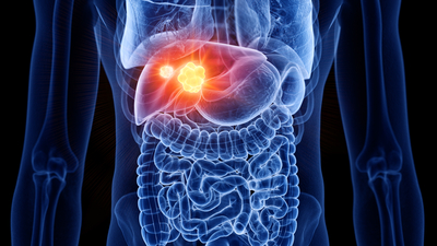 Korkunç! Hepatit B ve C'nin önüne geçti