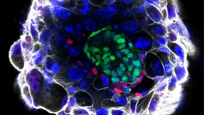 Sentetik insan embriyosu üretildi