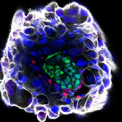 Sentetik insan embriyosu üretildi