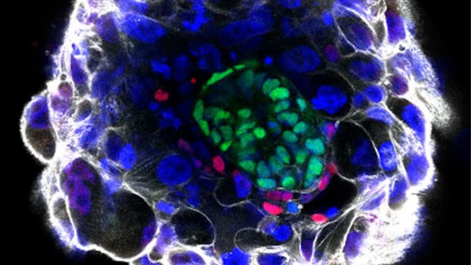 Sentetik insan embriyosu üretildi