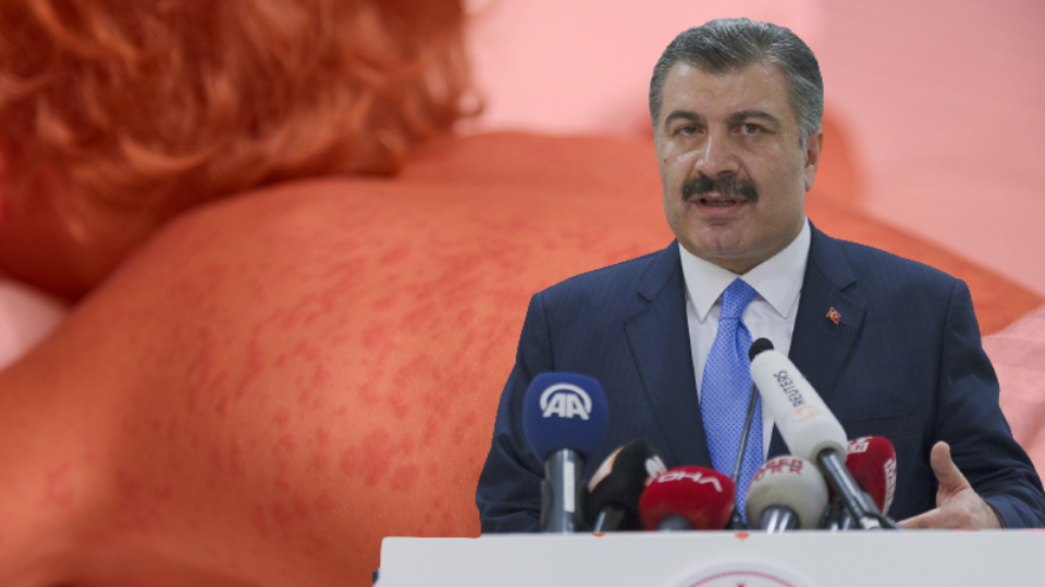 Bakan Koca'dan 'kızamık' açıklaması: Ölüm iddiaları asılsızdır