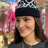 Köpek saldırısında üst dudağını kaybetti ama vazgeçmedi