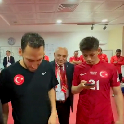 "Gözlerinden öperim"