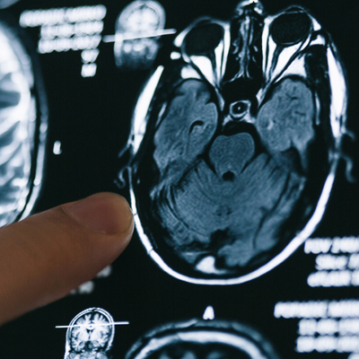 Gündüz uykusu beynin küçülmesini engelliyor