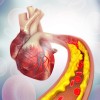 Kolesterolünüzü nasıl kontrol edebilirsiniz?