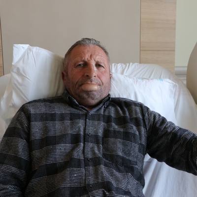 Kol derisinden dudak yapıldı