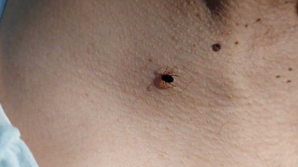 Piknik sonrası kene kontrolü uyarısı!