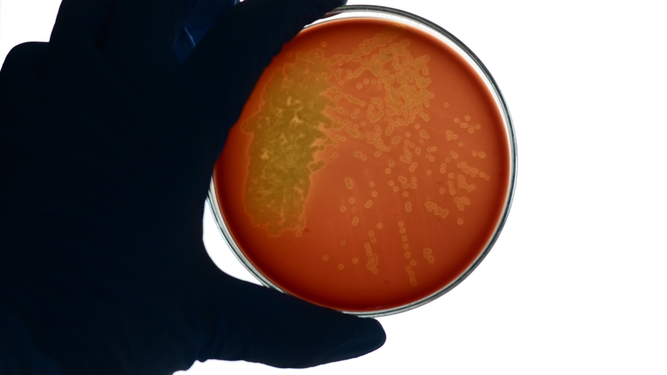 ABD Başkanı George Washington'ı öldüren hastalık! Strep A'da son durum ne?