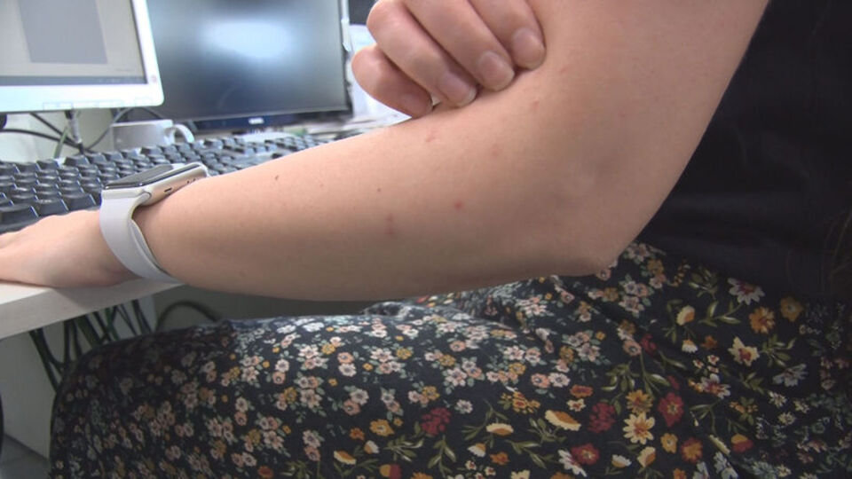 Diyabet hastalarına kritik sivrisinek uyarısı!