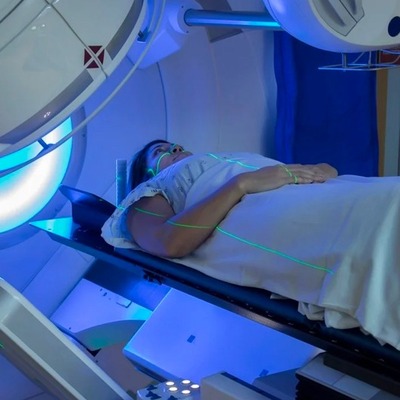 O kanser türünde radyoterapinin yan etkilerini azaltan şey ne?