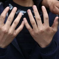 Bu belirtiler varsa vakit kaybetmeden doktora koşun!