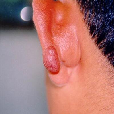 Uzmandan kan emen kum sineği uyarısı!