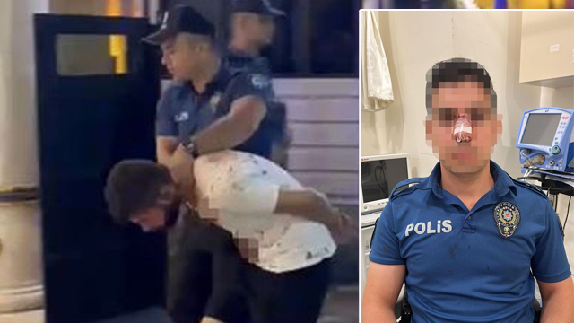 Şişe fırlatıp polisin burnunu kırdılar!
