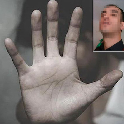 Bu kadarına pes! Engelli erkek komşuya cinsel saldırı!