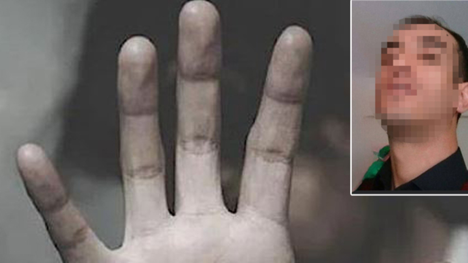 Bu kadarına pes! Engelli erkek komşuya cinsel saldırı!