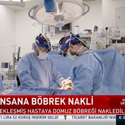 Domuzdan insana böbrek nakli