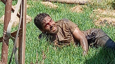 Kuduz paniği! Hastaneden kaçtı...