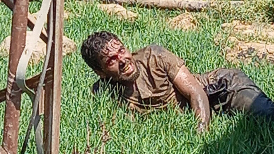 Kuduz paniği! Hastaneden kaçtı...