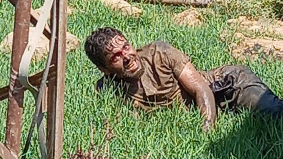 Cumartesi hastaneye kaldıran kuduz hastası hayatını kaybetti