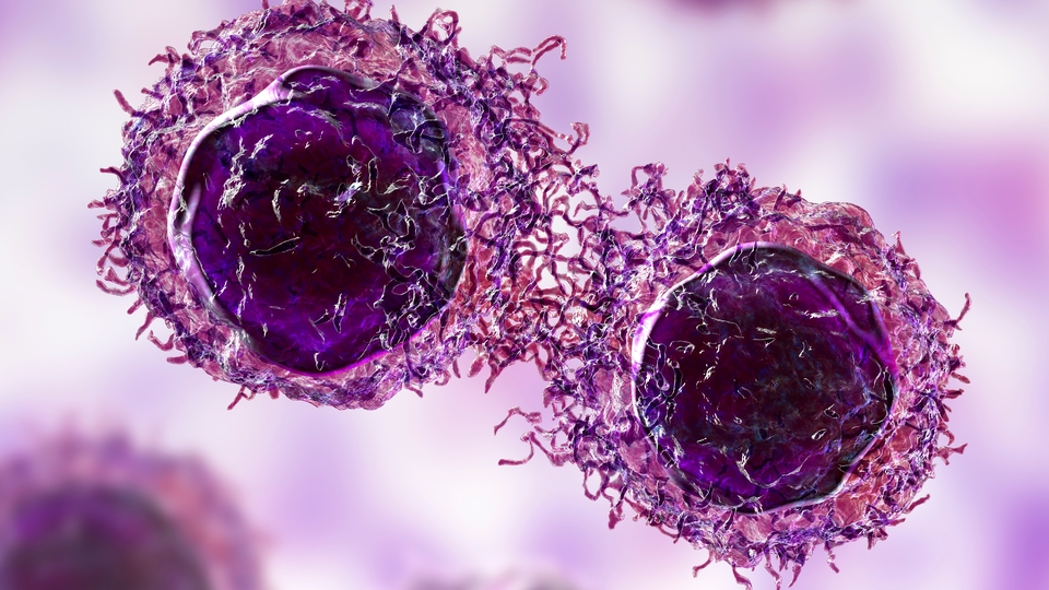 Yapay zekayla o kanserin evresi anında bilinecek