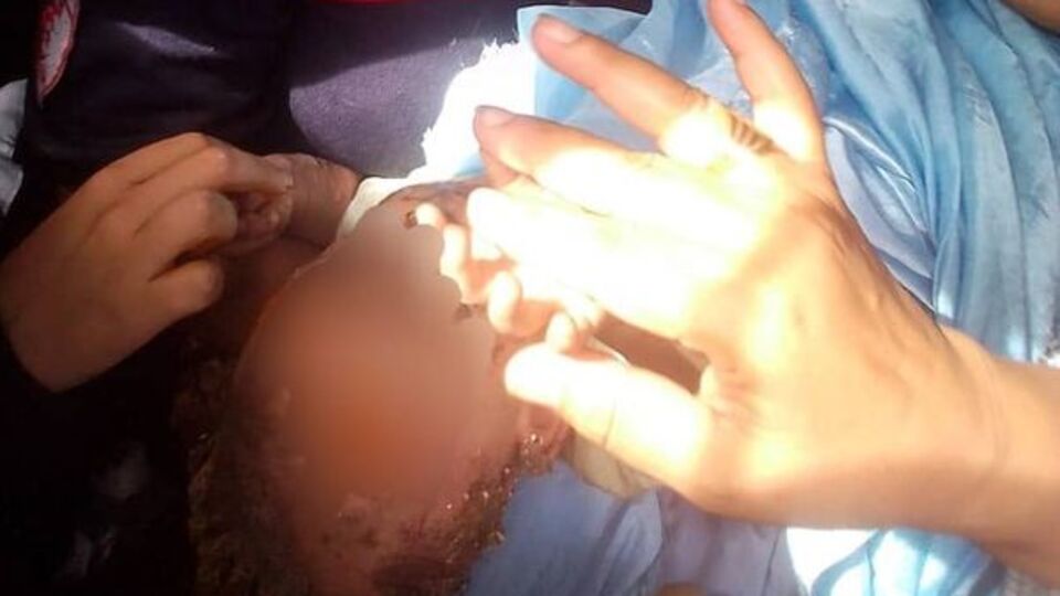 9 aylık bebeğin inanılmaz kurtuluşu