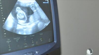 Meksika'da kürtaj federal düzeyde suç olmaktan çıkarıldı