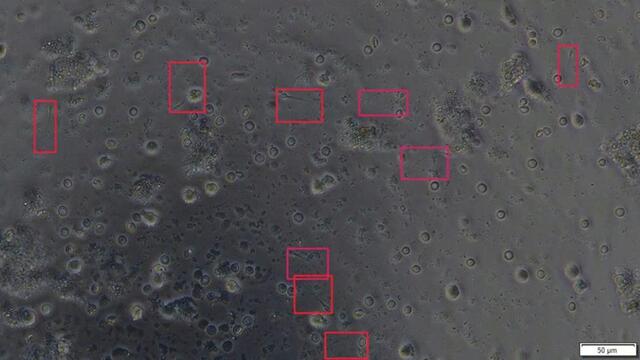 Yapay zeka erkek kısırlığının tedavisinde sperm tespitini 1.000 kat hızlandırabilir