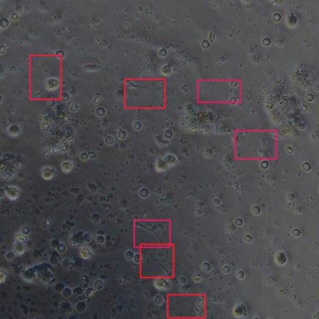 Yapay zeka erkek kısırlığının tedavisinde sperm tespitini 1.000 kat hızlandırabilir