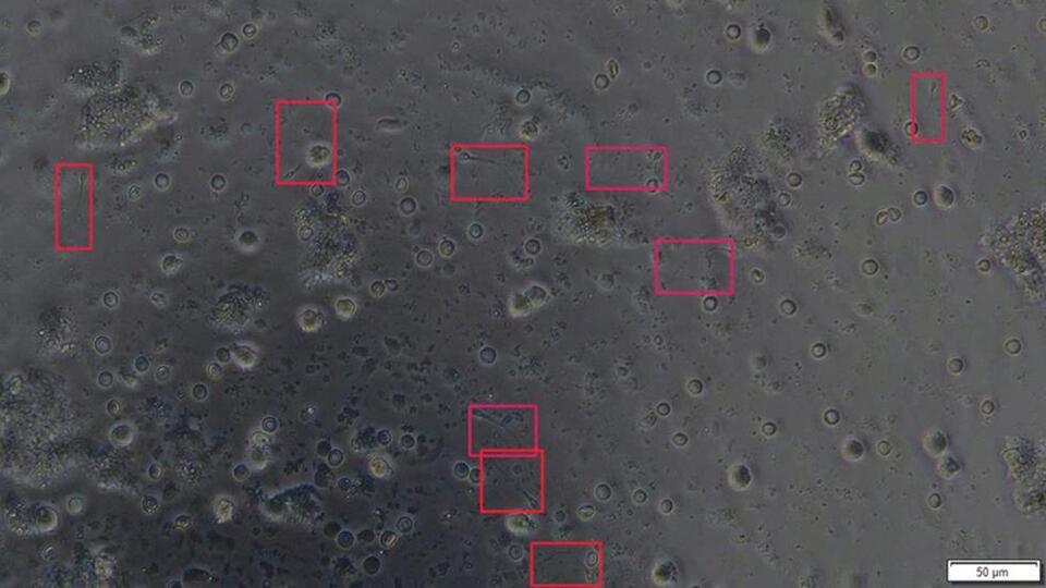 Yapay zeka erkek kısırlığının tedavisinde sperm tespitini 1.000 kat hızlandırabilir