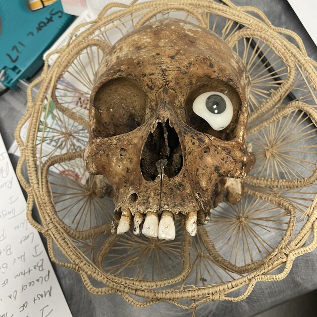  Bağış kutusundan insan kafatası çıktı