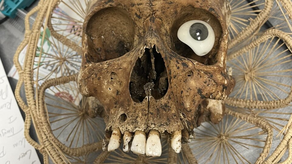 Bağış kutusundan insan kafatası çıktı