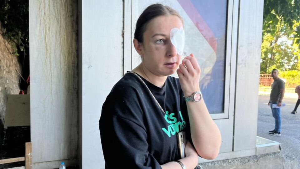 Eski sevgilisi öldüresiye dövdü! 9 kez yüzüne kafa attı