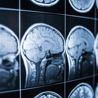 Eris varyantı habercisi!