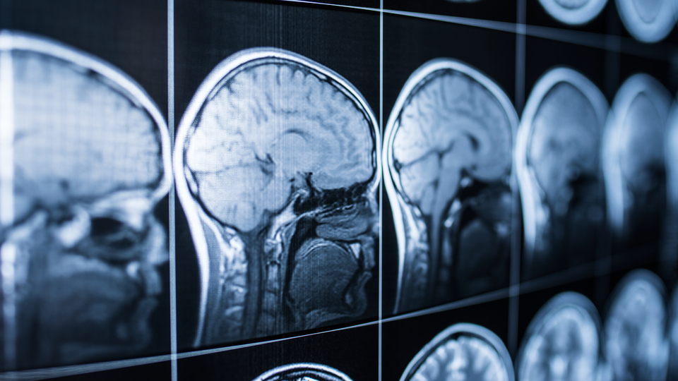 Eris varyantı habercisi!