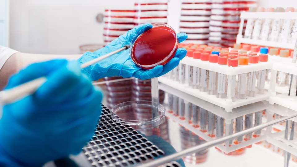 Sepsis tedavisinde her saniye "hayati" önem taşıyor