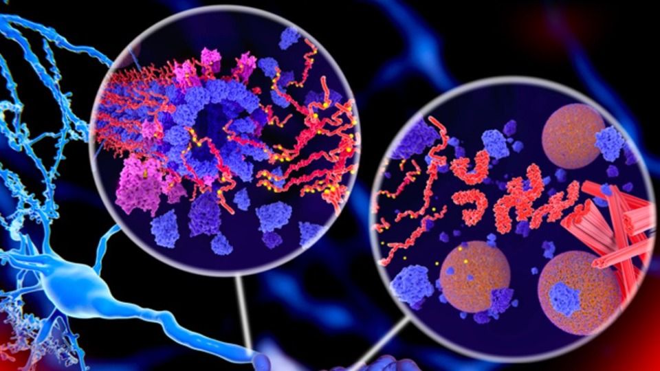 Uzmanlara göre 2023 bir milat! Alzheimer'a yol açan sorunu ortadan kaldırıyor mu?