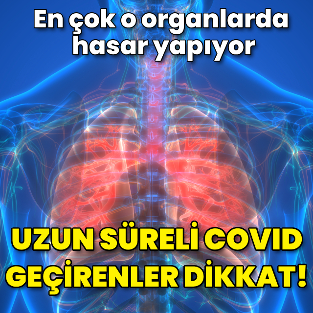 Uzun süreli Covid geçirenler dikkat!