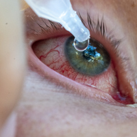 "Kırmızı göz" yayılmaya devam ediyor!