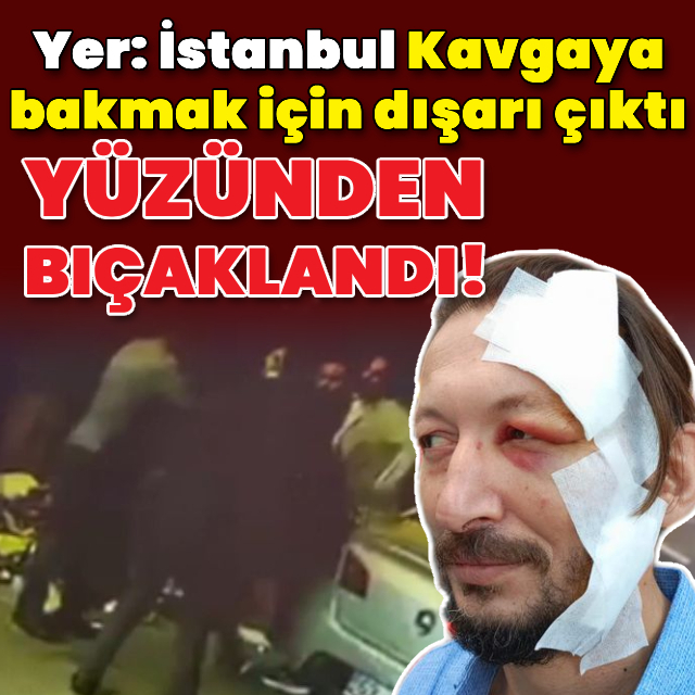 'Ne bakıyorsun' diyerek esnafı yüzünden bıçakladı!