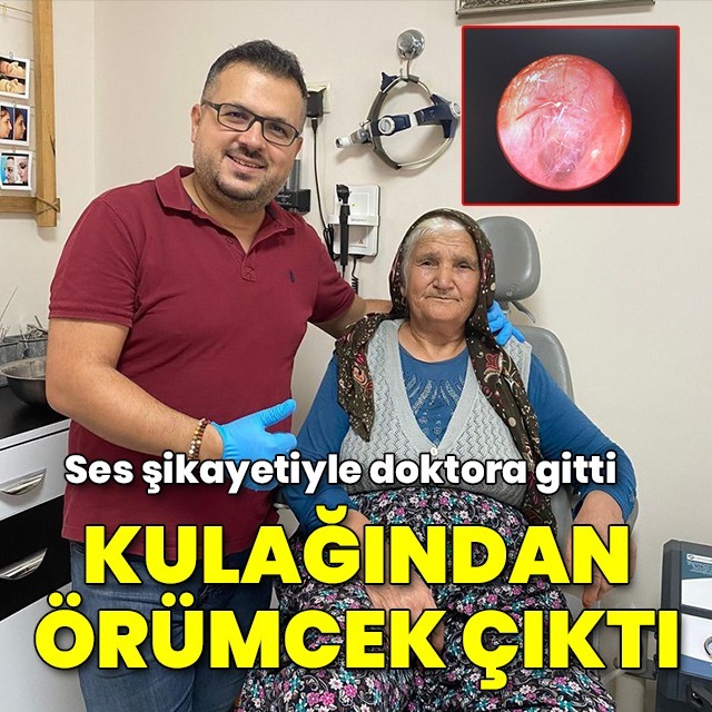 Kulağındaki örümcek operasyonla çıkarıldı