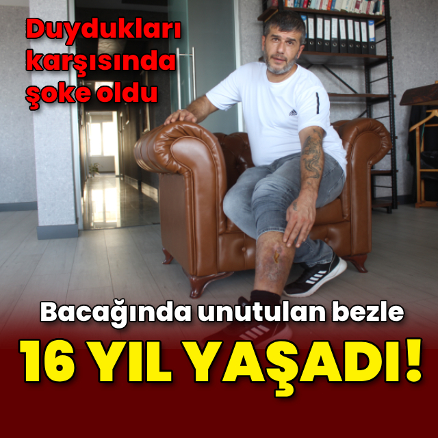 Bacağında unutulan bez parçasıyla 16 yıl yaşadı