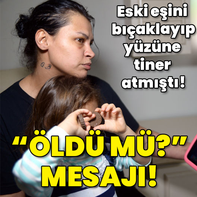 Eski eşini bıçaklayıp, yüzüne tiner attı! "Öldü mü" diye mesaj yolladı!
