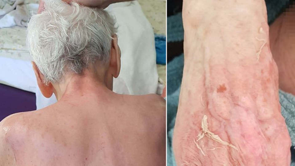 Huzurevindeki ölümde kan donduran rapor! Kaynar suyla haşlandı!