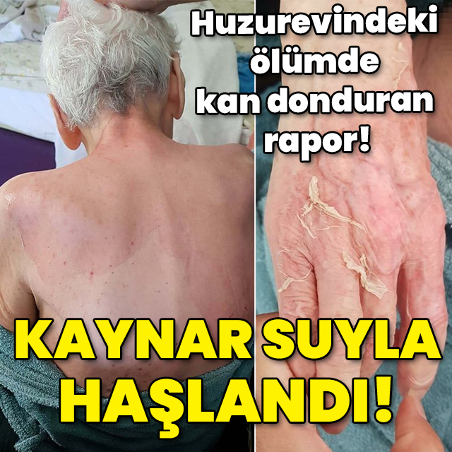 Huzurevindeki ölümde kan donduran rapor! Kaynar suyla haşlandı!